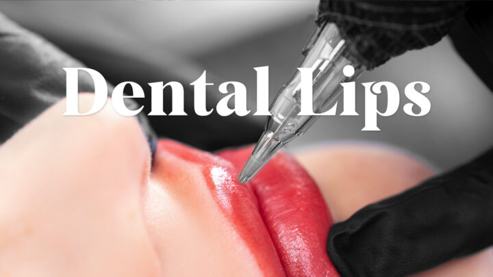 歯科リップ専門コース